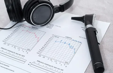 Audiogram interpretation