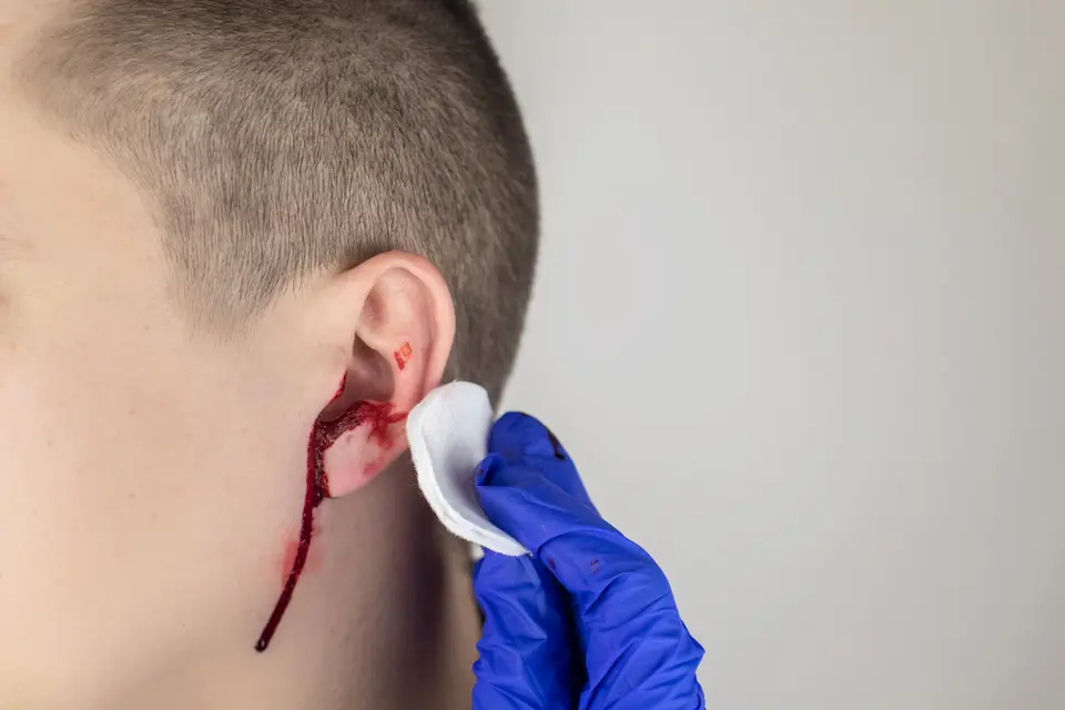 Ear Bleeding